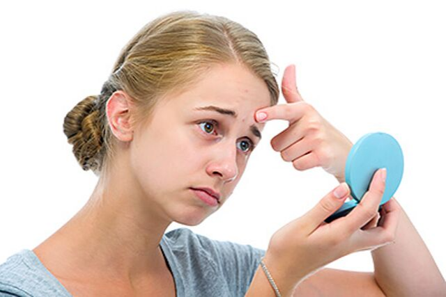Treat Acne